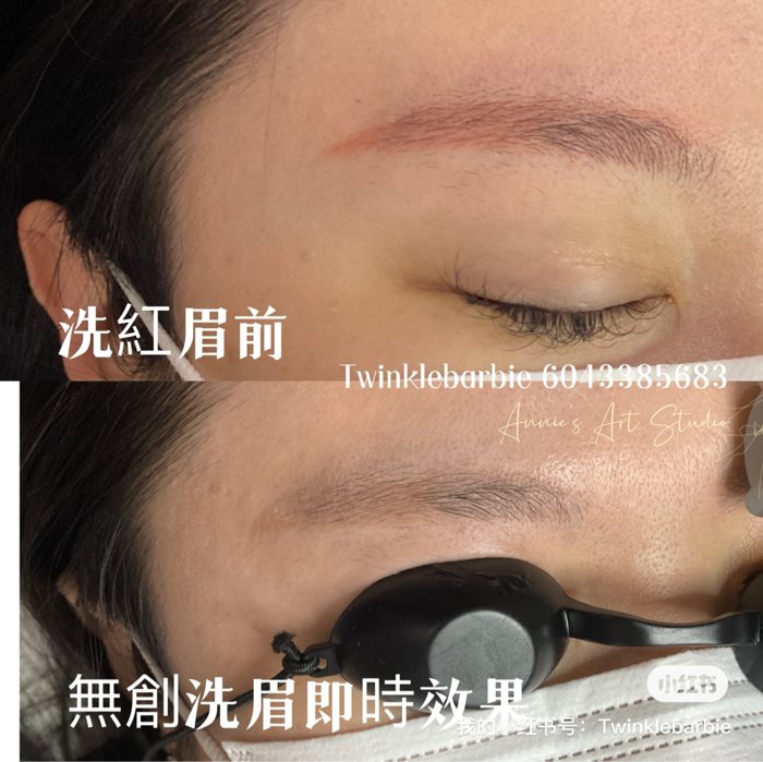 无创洗红眉前后对比